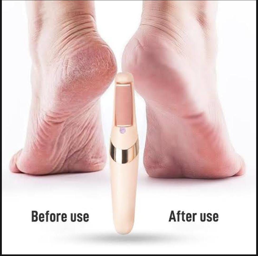 Rechargeable Electric Pedi Foot Filer Effective Callus Remover For Soft Smooth Feet